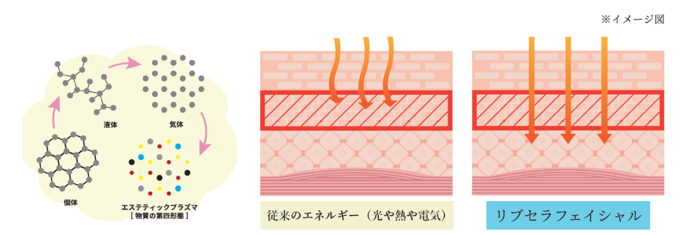 リブセラプラズマフェイシャルイメージ図