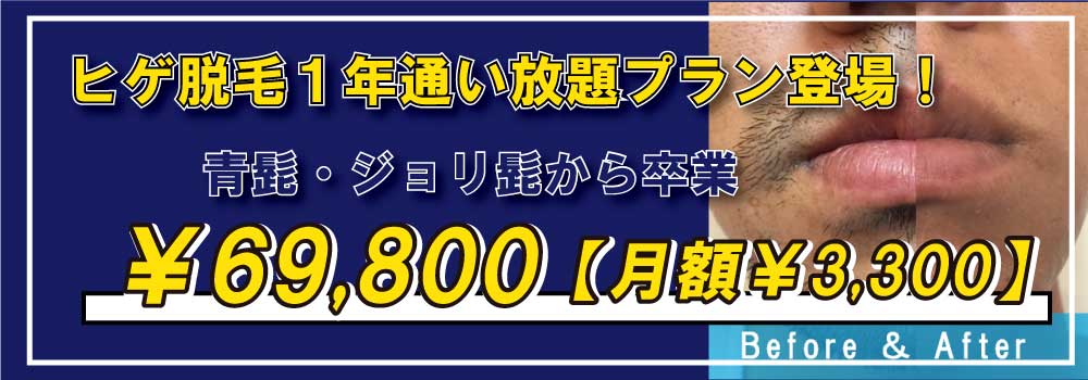 ZERO心斎橋のヒゲ脱毛通い放題メニュー