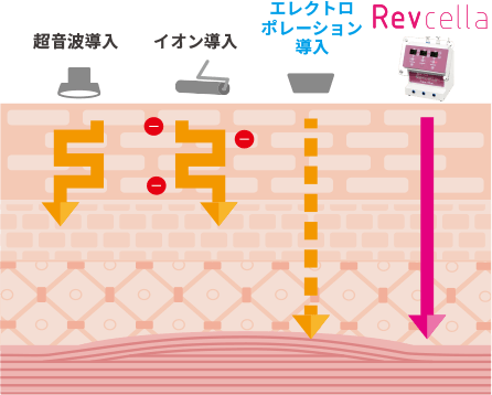 従来の頭皮ケアと他社比較 MOUMITUエステで使用する「プラズマ美容機器」はエレクトロポレーションや超音波導入などに比べ、皮膚表面や正常な組織にダメージを与えることなく安全に、より効果的に頭皮へアプローチします。「プラズマ美容機器」を使用することよって他社製品ではできないスカルプケアを実現し差別化を図れます。