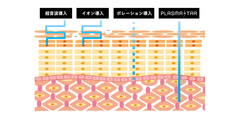 美容プラズマの効果とは?従来の機器のイオン導入、超音波導入、ポレーションでは不可能だった、深部までアプローチできる美容施術方法