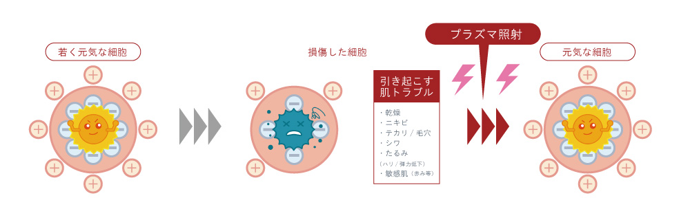 美ヨウ部のプラズマ機器と、他社のプラズマ機器との違い、ベビー細胞膜の電位バランスを正常化