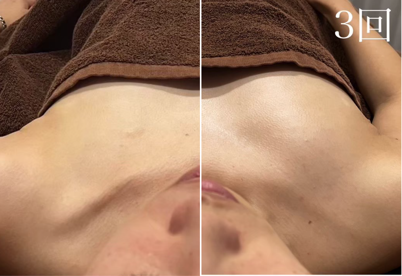 プラズマスター、結果写真、バストアップ