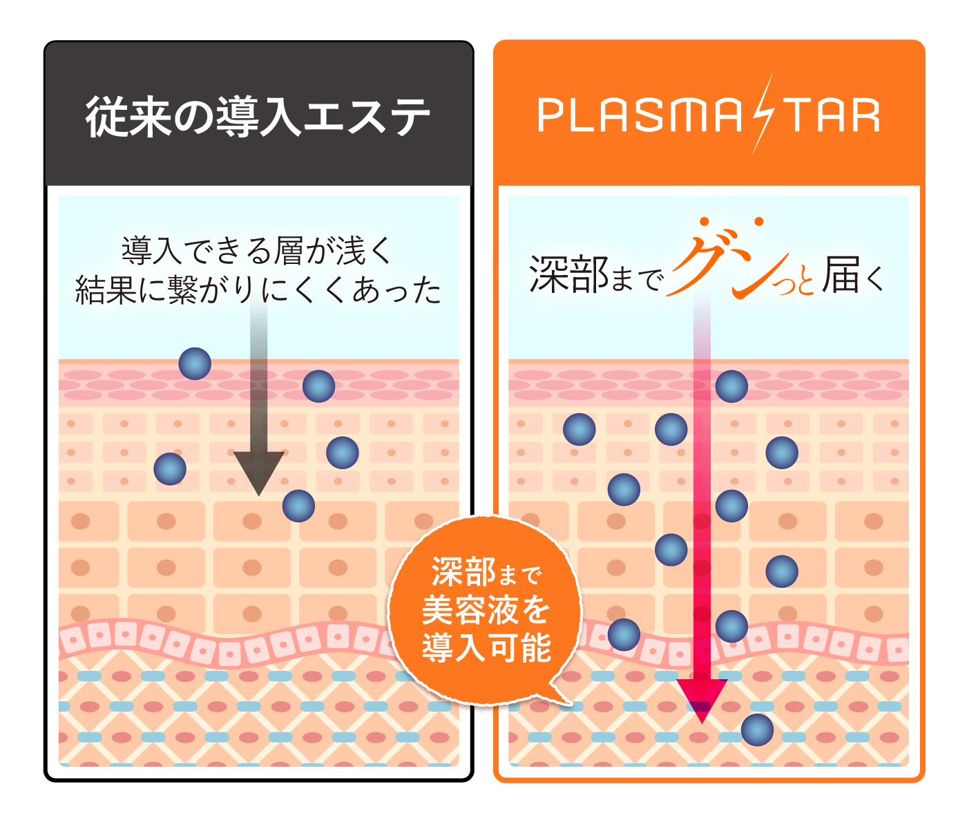 プラズマスターのプラズマは純度100%プラズマで導入効果は段違い