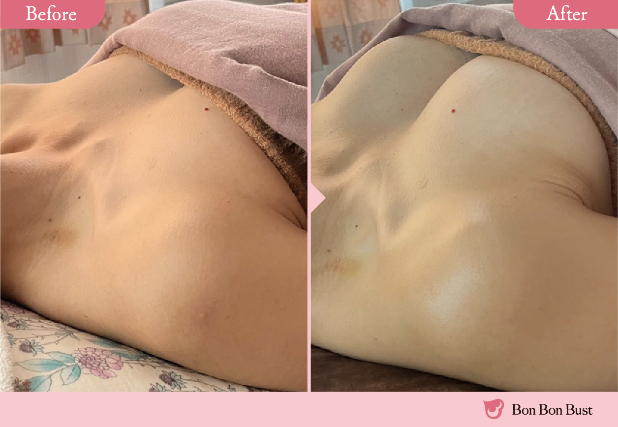 美ヨウ部、ボンボンバスト、バストアップスクール、結果写真3