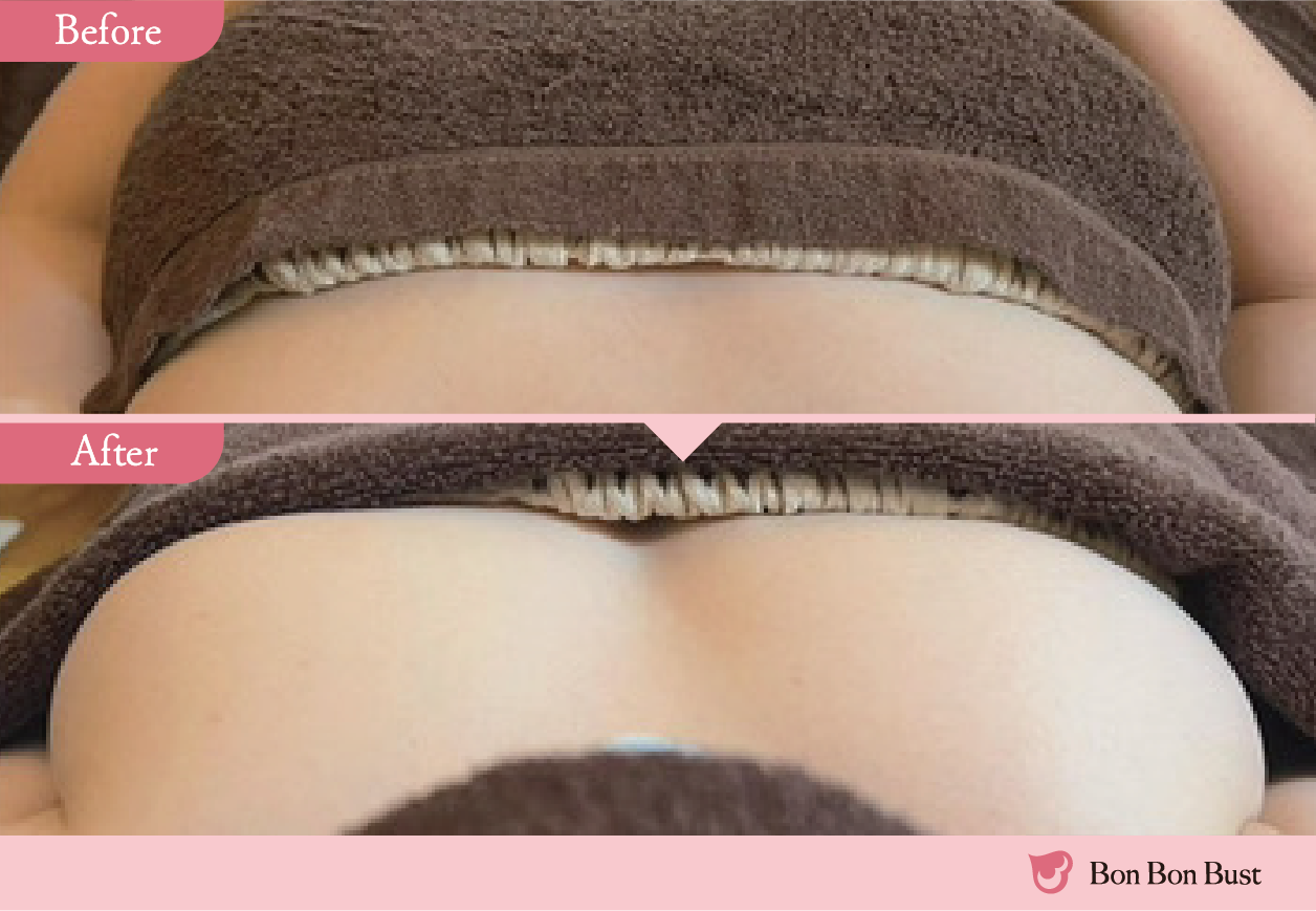 美ヨウ部、ボンボンバスト、バストアップスクール、結果写真7